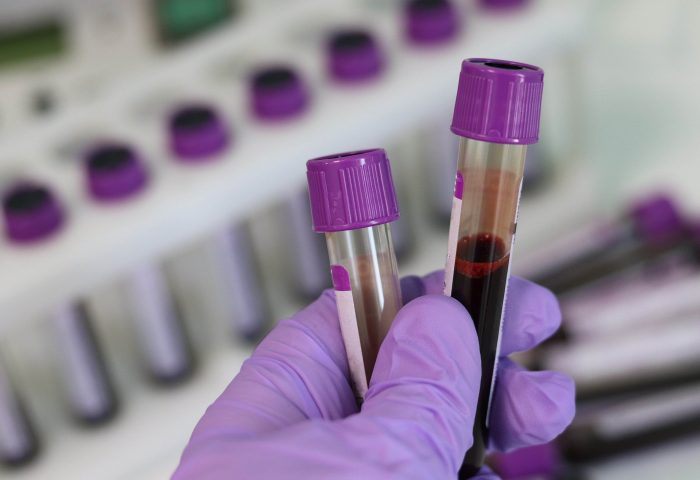 LifeLabs $30 home visit fee an equity issue, says area woman